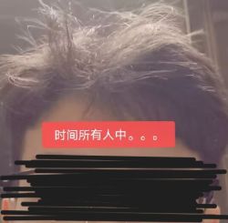 电击枪的头
